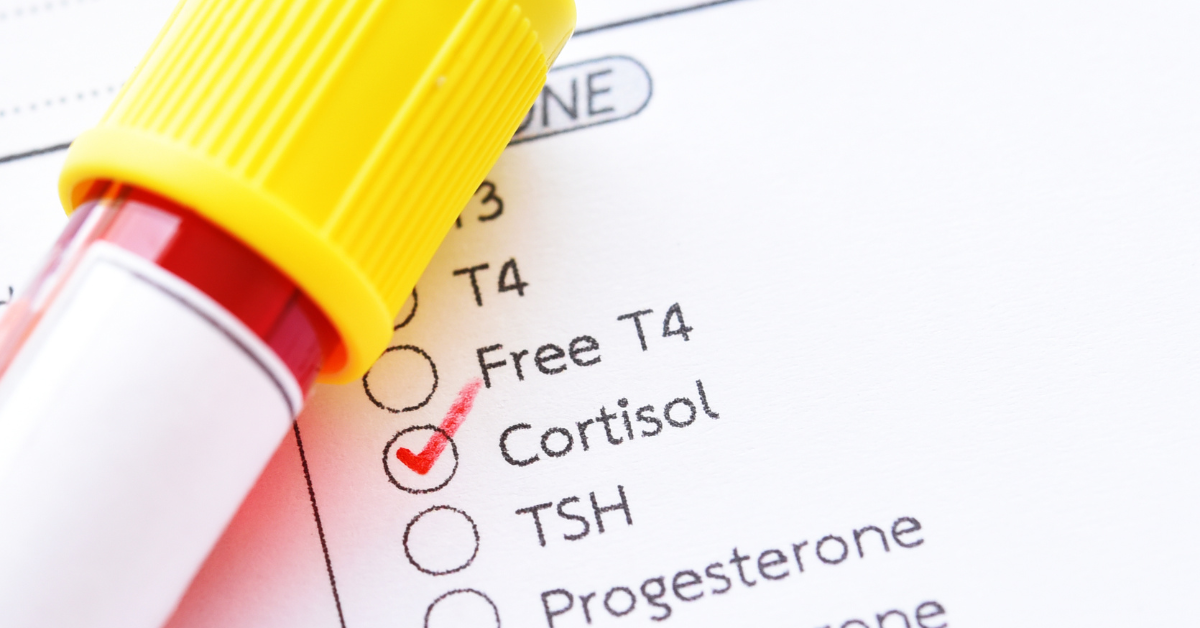 How Cortisol Can Destroy Your Testosterone Production